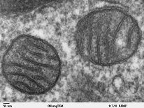 Mitochondria%2C_mammalian_lung_-_TEM.jpg-1.jpg
